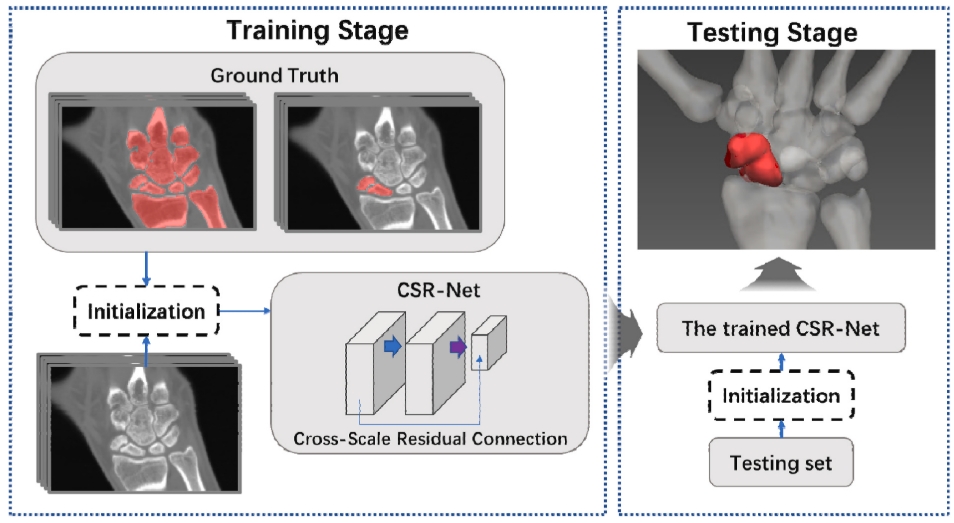 CSR-Net: Cross-Scale Residual Network for scaphoid fracture segmentation