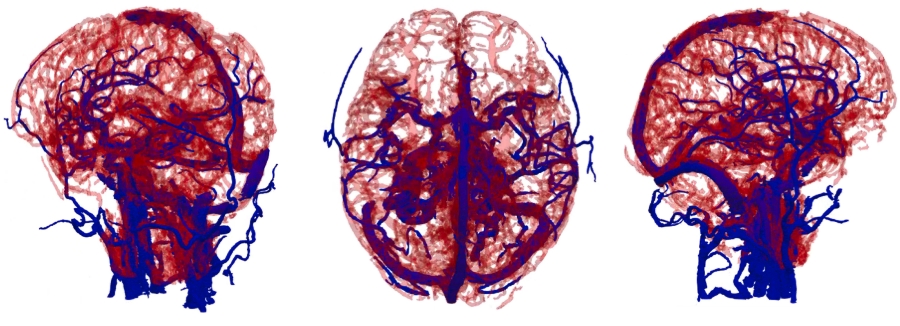 Cerebrovascular segmentation in phase contrast MRA by multi-feature fusion and vessel completion