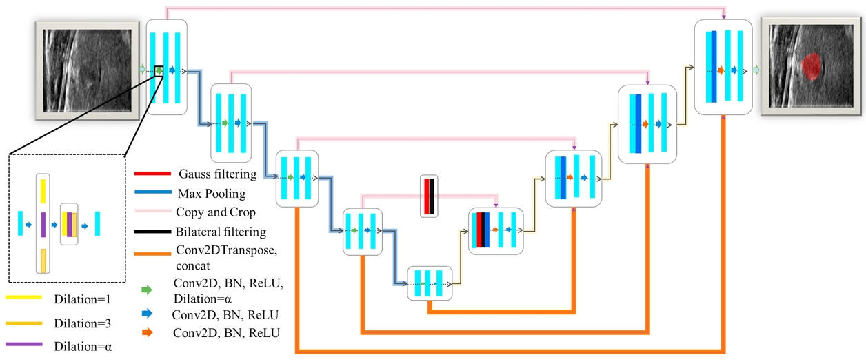 FDE-net: Frequency-domain enhancement network for thyroid nodule segmentation