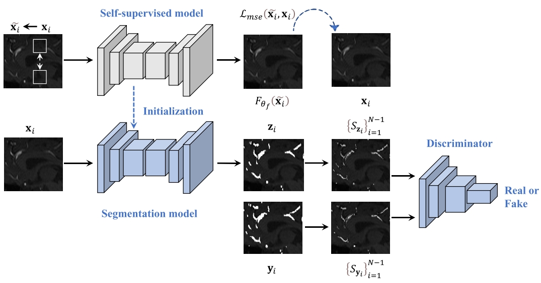 Cerebrovascular segmentation in TOF-MRA with topology regularization adversarial model