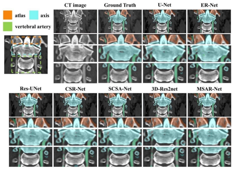 MSAR-Net: A multi-scale attention residual network for medical image segmentation